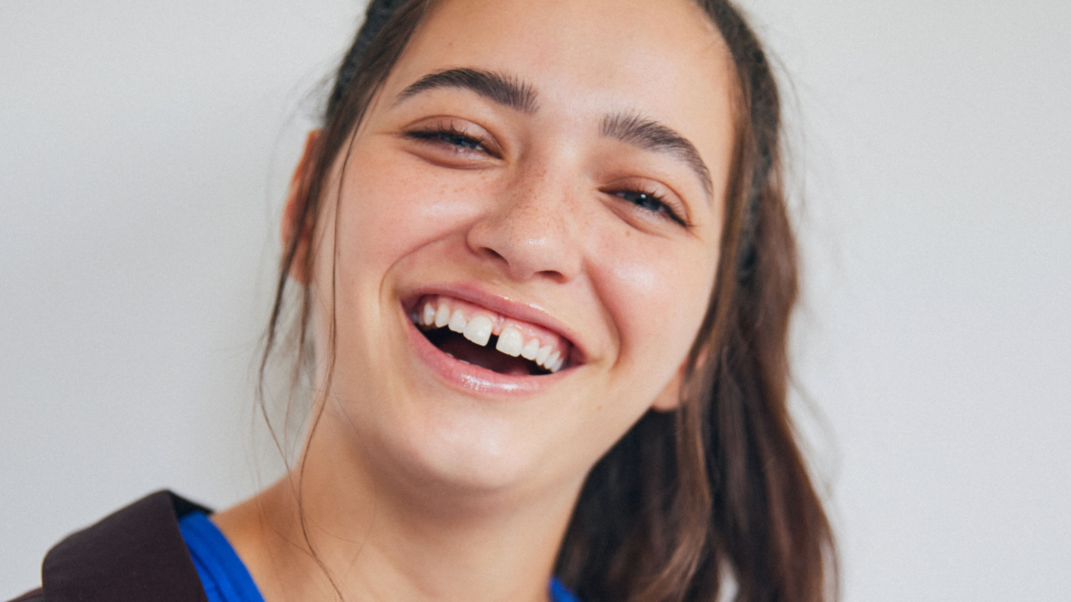 Healthy vs. Unhealthy Gums