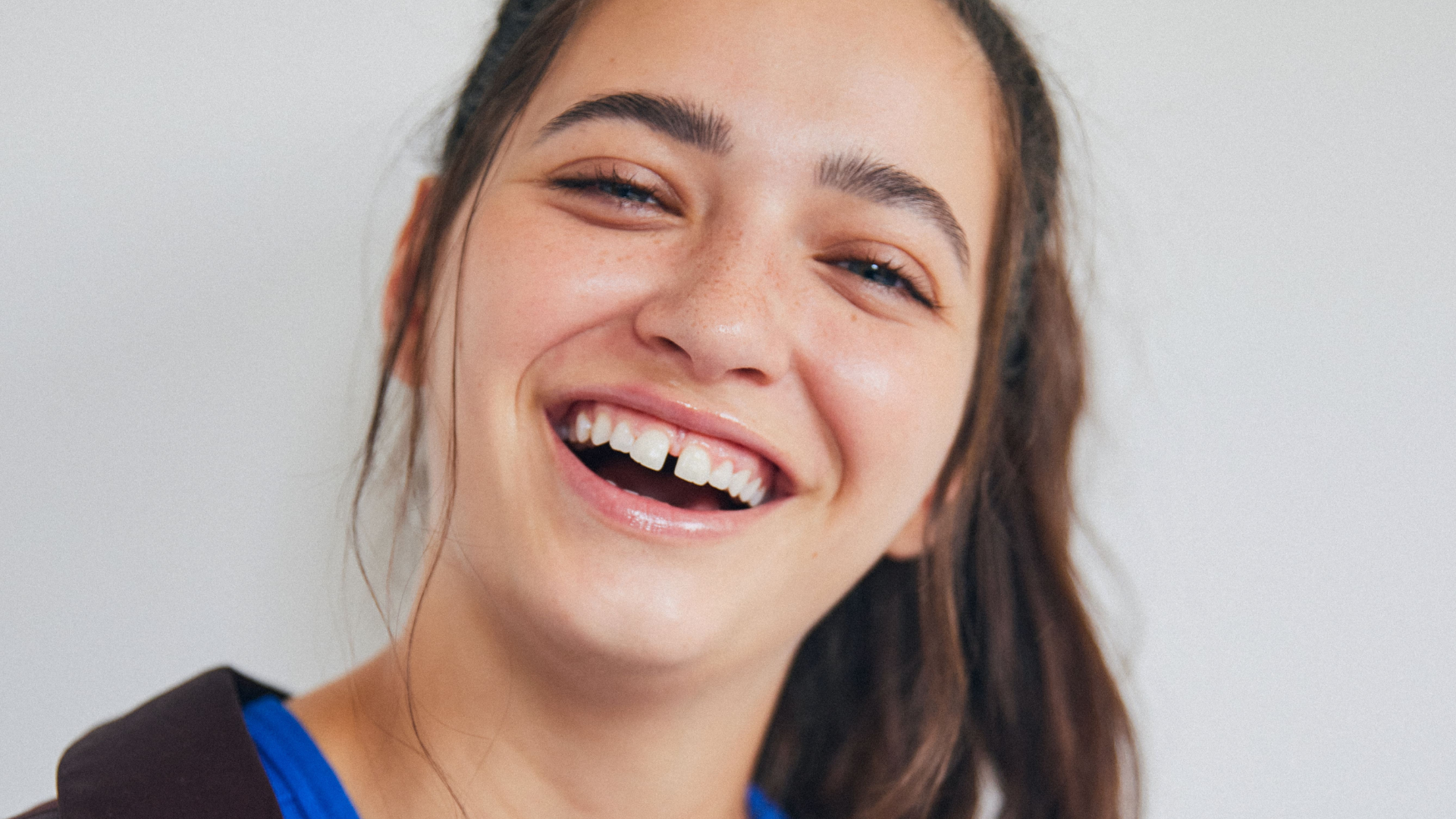 Healthy vs. Unhealthy Gums